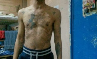 Προειδοποιούν με απεργία πείνας οι ασθενείς κρατούμενοι στον Κορυδαλλό