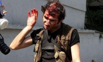 Κωνσταντινούπολη: Δεκάδες τραυματίες στις βίαιες οδομαχίες