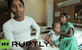 Ινδία: Καλά τα νέα για την μικρή Ρούνα με την ακραία υδροκεφαλία (βίντεο)