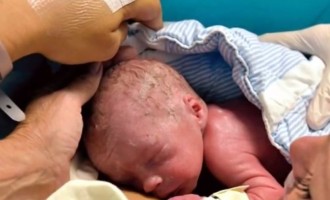 Δείτε το πρώτο παιδί που γεννήθηκε μετά από μεταμόσχευση μήτρας (βίντεο)