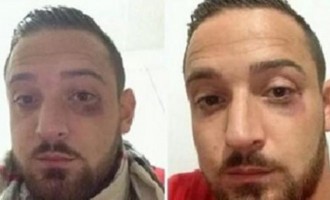 Ποδοσφαιριστής ξυλοκοπήθηκε άγρια στην Άγκυρα από τζιχαντιστές