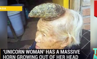 Κινέζα έβγαλε κέρατο 12 εκατοστών πάνω στο κεφάλι της (βίντεο)