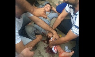 Τούρκοι ελεύθεροι σκοπευτές πυροβολούν τα παιδιά των Κούρδων (σκληρές φωτο)