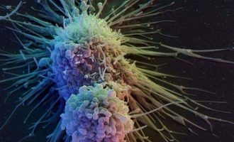 Φάρμακο τεχνητής νοημοσύνης «φρενάρει» τον καρκίνο