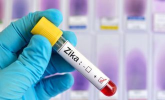 Ανακαλύφθηκαν αντισώματα που εξουδετερώνουν τον ιό Ζίκα