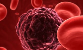 Τεστ αίματος ανιχνεύει τον καρκίνο πριν εμφανιστούν τα κύρια συμπτώματα