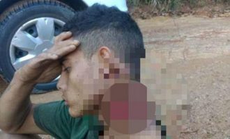 Βραζιλία: Με κομμένο λαιμό περπάτησε μισο-αποκεφαλισμένος για να σωθεί (βίντεο)