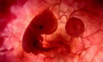 Επιστημονικό θαύμα: Τροποποίησαν ελαττωματικά γονίδια σε ανθρώπινα έμβρυα