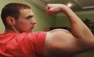 21χρονος Ρώσος έκανε “μπράτσα” με παυσίπονα και αλκοόλ (βίντεο)