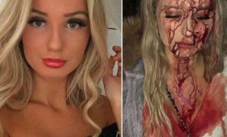 Σοκ στη Σουηδία: Πρώτα τη χούφτωσαν και μετά της έσπασαν το κεφάλι με μπουκάλι (φωτο)