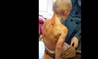 Αδιανόητο: Μαστίγωσαν 4χρονο Ρωσάκι γιατί δεν ήξερε να μετράει μέχρι το πέντε (φωτο)
