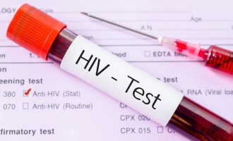 Σε ποια χώρα θα γίνονται ατομικά τεστ αυτοδιάγνωσης του ιού HIV από τα φαρμακεία