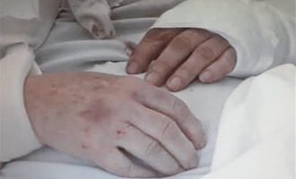 84χρονη ξυλοκοπήθηκε άγρια επί ώρες στο Παγκράτι μέχρι να τη ληστέψουν