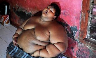 Το πιο χοντρό παιδί του κόσμου έχασε 80 κιλά (φωτο)
