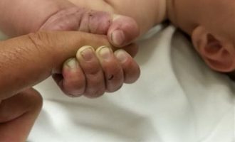 Μωρό στις ΗΠΑ με 51.418 φορές μεγαλύτερο ιικό φορτίο και άγνωστη μετάλλαξη του κορωνοϊού