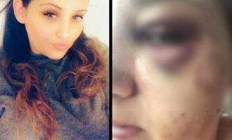 Εφιάλτης για 26χρονη: Την έκαψε με τσιγάρο, την έλουσε με χλωρίνη και τη μαχαίρωσε γιατί ζήλευε