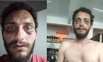 Καταγγελία: Αστυνομικοί πλάκωσαν στο ξύλο Κρητικό γιατί τον πέρασαν για Πακιστανό