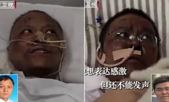 Πέθανε ο Κινέζος γιατρός που είχε μαυρίσει το δέρμα του από τον κορωνοϊό