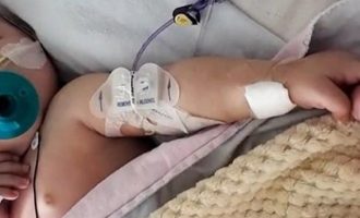 Βραζιλία: Γεννήθηκε αγοράκι με δύο πέη – Χειρουργοί του ακρωτηρίασαν το μεγαλύτερο
