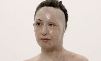Επίθεση με βιτριόλι: Η Ιωάννα Παλιοσπύρου έβγαλε τη μάσκα (φωτο)
