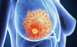 Ελπιδοφόρο το φάρμακο Enhertu στη θεραπεία του καρκίνου του μαστού – «Θαυματουργό» το dostarlimab