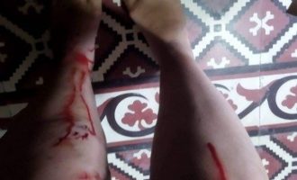 Βόλος: Σε ασφαλή χώρο η 26χρονη που απειλήθηκε με κατσαβίδι από 34χρονο