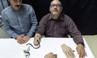 Βιονικό προσθετικό χέρι νιώθει τη ζεστασιά της ανθρώπινης επαφής (βίντεο)